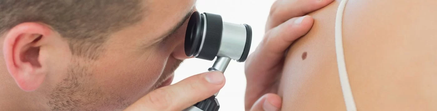 A dermatologist using a dermatoscope to examine a mole on a patients skin.