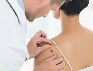 A healthcare professional examining a patients mole or skin condition.